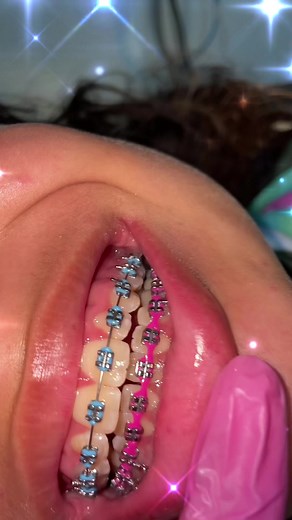 Mendez Dental Clinic: Brackets and Orthodontic Ligatures