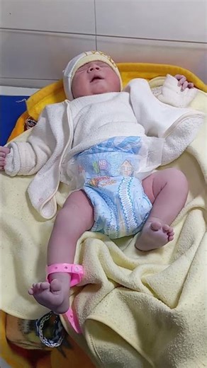 accrocynosis baby and mild respiratory problems