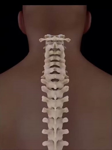 Cervical Facet Syndrome