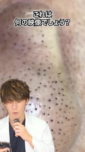 【あきよし先生解説】いちご鼻の角栓を力任せに除去はNG！肌への危険性とは