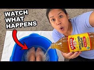 Put Vinegar on Your Feet and Watch What Happens (7 Vinegar Uses Latina Mothers Swear By)