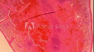 Microscope Dog Spleen Section x1200