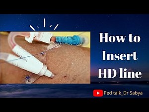 Insertion of HD line/ Hemodialysis line/ Plasma exchange line/ #DrSabya