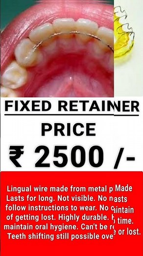 Types of Retainers after Braces #braces #bracestreatment #retainers #lingualbraces #typesofbraces