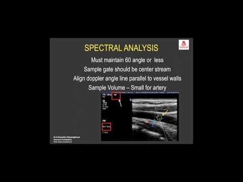 Applied physics color doppler