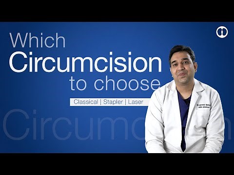 कौन सा खतना सबसे अच्छा है? क्लासिक स्टेपलर या लेज़र