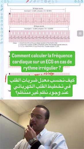 MedXAziz on Instagram‎: "Comment calculer la fréquence cardiaque sur un ECG en cas de rythme irrégulier ? 👉 كيف نحسب معدل ضربات القلب في تخطيط القلب الكهربائي عند وجود نظم غير منتظم؟"‎