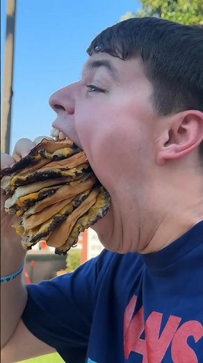 This Is What Dentist Mean When They Say Open WIDE! 😮🍔