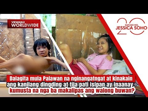 Dalagita na kinakain ang dingding, kumusta na makalipas ang walong buwan? | Kapuso Mo, Jessica Soho