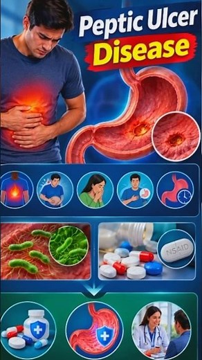 What is Peptic Ulcer Disease? 3D Medical Animation | H. pylori & NSAIDs` #healtheducation #anatomy