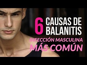 6 Causes of Balanitis (the most common male infection) 👨‍⚕️