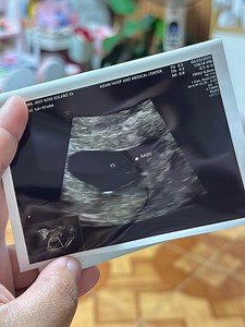 455K views · 11K reactions | First check up & First Ultrasound | Life with Alex | Facebook