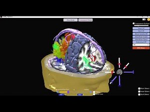 Neuroguide - Loreta Absolute Power