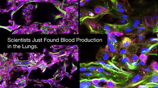 Your lungs make blood too. UCSF scientists just discovered lung stem cells that produce blood, just like bone marrow. This could change how we treat blood and immune disorders. | UCSF