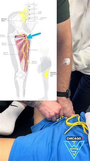 This Hidden Nerve Is Causing Your Groin Pain!