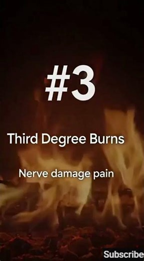 Top 5 Most Painful Things a Human Can Experience