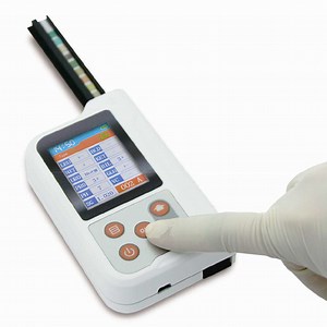 [Hot Item] China Automatic Lab Equipment Handheld Portable Urine Analyzer