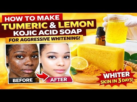 DIY TURMERIC & LEMON KOJIC SOAP 😱 REMOVE DARK SPOTS FAST