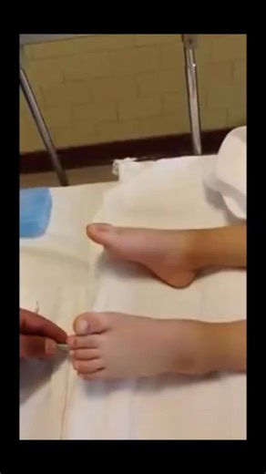 Le Signe de Babinski #health #positivevibes #fitness | Médecine Pour Tous