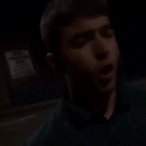 So this is how xfactors Anthony (tighto) got his black eye. :-( #xfactor | Life In Liverpool