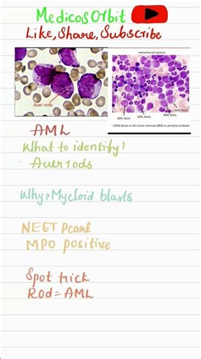 ONE TRICK TO DIAGNOSE AML INSTANTLY #mbbs #study #viral