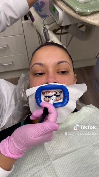 The complete procedure shown here is Teeth Whitening!!! Our zoom Teeth whitening treatment is designed to bring your stained teeth to pearly white in minutes 🦷🦷🤩 Get up to 8 Shades Whiter... Whitening Procedures 🦷REGULAR PRICE $799 🦷SPECIAL PRICE $399 Call today to book your Appointment ☎️ (614) 766-5600 http://myDMD.us/rXp750Mfr4O . #dental #dentist #dentistry #smile #teeth #dentista #odontologia #dentalcare #tooth #dentalclinic #dentalhygienist #orthodontics #oralhealth #dentalimplants #d
