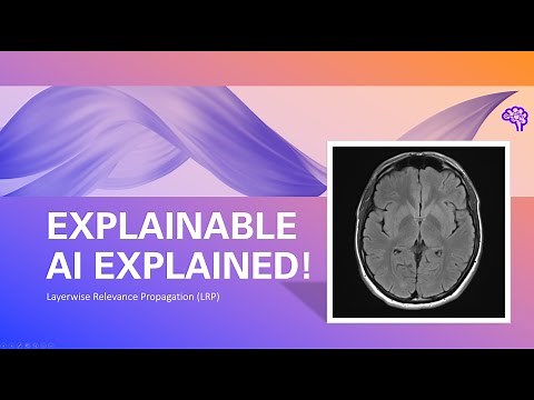 Explainable AI explained! | #6 Layerwise Relevance Propagation with MRI data