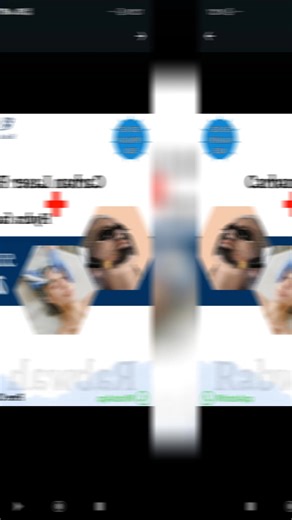 Transform Your Skin with Carbon Laser and HydraFacial