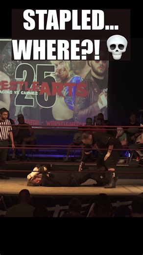 HE ACTUALLY DID IT! 😱 Pondo Ignores Fan Pleas and Staples Prophet