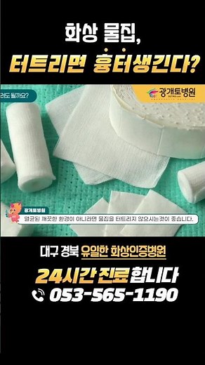 화상물집 터트리면 안되는 이유 #화상치료 #화상흉터 #화상물집치료