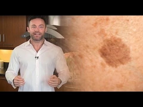 Remove Brown Spots On Face And Skin With This Simple Trick!