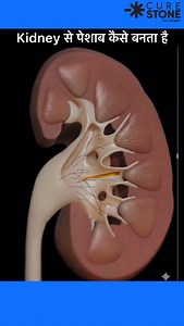 10K views · 584 reactions | Ever wondered how urine actually flows inside your kidneys?  Watch this 3D animation—it’s mind-blowing! ✨” #KidneyHealth #3DAnimation #MedicalReels #UrineFlow #HealthAwareness #KidneyCare #MedicalAnimation #ViralReels #CureStone #ScienceIn3D | Cure Stone | Facebook