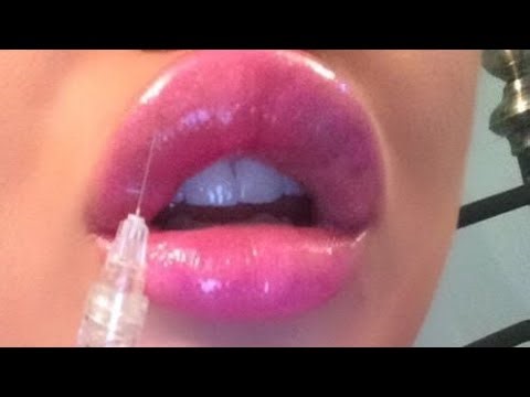꧁༺ Lip Curse ✦ Explosively Huge Lips ༻꧂ 💋|𝑬𝒙𝒕𝒓𝒆𝒎𝒆 𝑺𝒖𝒃𝒍𝒊𝒎𝒊𝒏𝒂𝒍⚠️