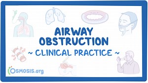 Airway obstruction: Video & Meaning | Osmosis