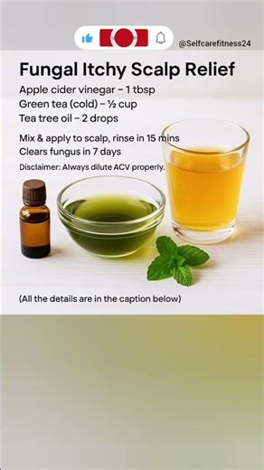 Stop scalp itching naturally in 7 days! ❌🤕 #ScalpItching #FungalInfection #shorts