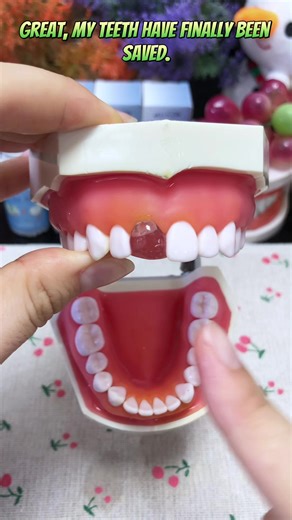Temporary Dental Adhesives for Home Tooth Repair