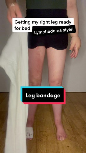 Getting my #lymphedema leg ready for bed with thr #bandages for #compressiontherapy @facciolita #chronicillness