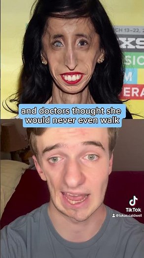 “Ugliest Person in the World”