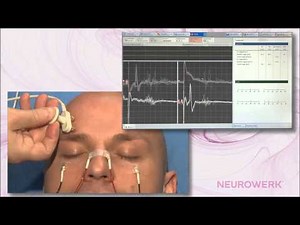 Reflexes - Blink Reflex