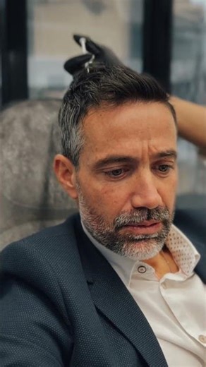 3 Σημάδια Τριχόπτωσης στους Άνδρες | Πότε Χρειάζονται Θεραπείες Μαλλιών