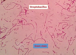 Streptobacillus Gram stain: Introduction, Principle, Procedure and Result