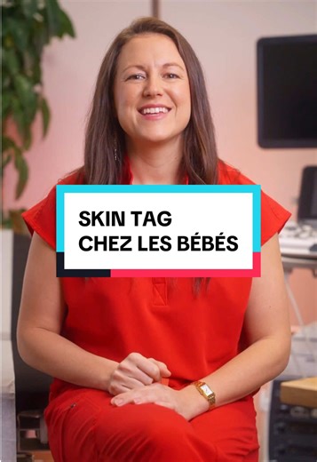 Skin tag à l’oreille de bébé #bébé #bébémignon