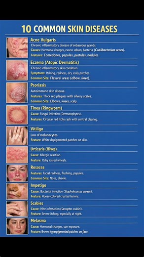 10 common skin diseases