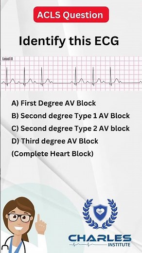 ACLS Sample question ECG #ecginterpretation #acls #americanheartassociation