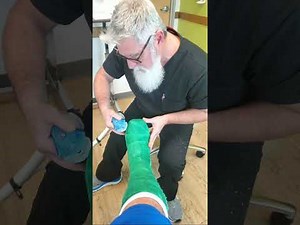 Total Contact Short Leg Cast, (part 2 of 2- how to remove)