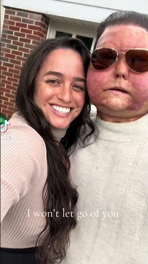Joe Dimeo - From Burn Victim To Hero