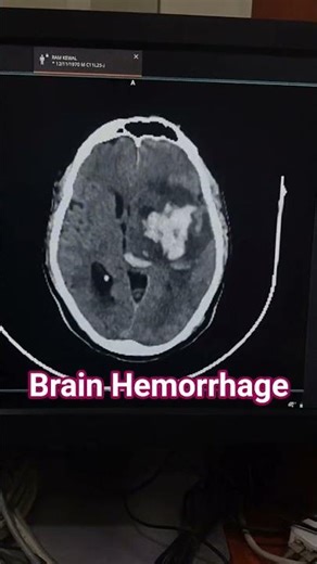 CT Head #motivation #bestmedicalcollegeinindia #radiologictechnologist #doctor