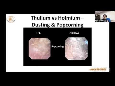 THULIUM FIBER LASER BY DR.V.CHANDRA MOHAN