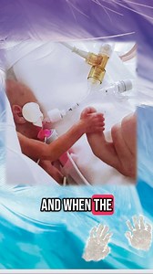 216K views · 1.8K reactions | Our final goodbye ️ | Daisy & Lily one in heaven one on earth - miracle twins UK | Facebook