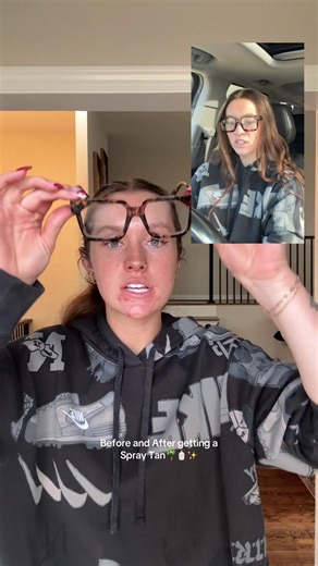 Before and After My Spray Tan Transformation